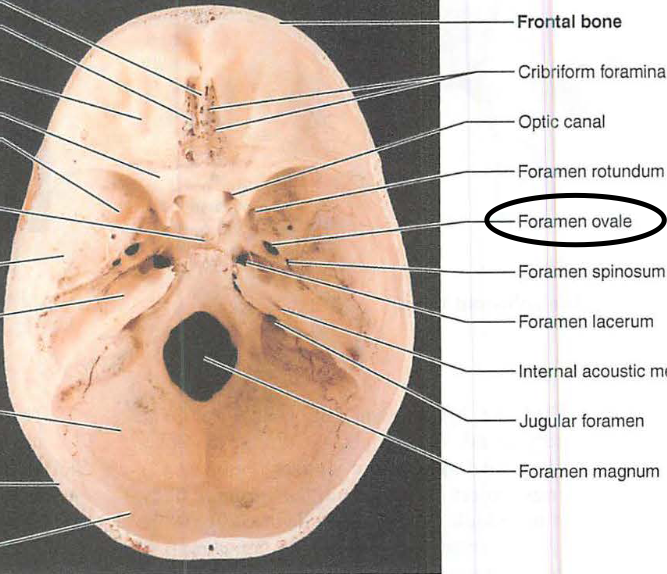 <p>v. foramen ovale</p>