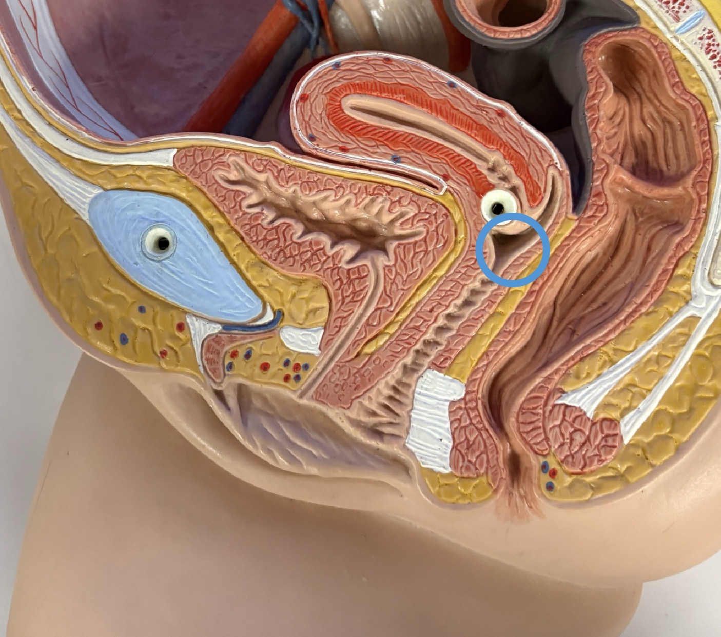 <p>inferior outlet into vagina</p>