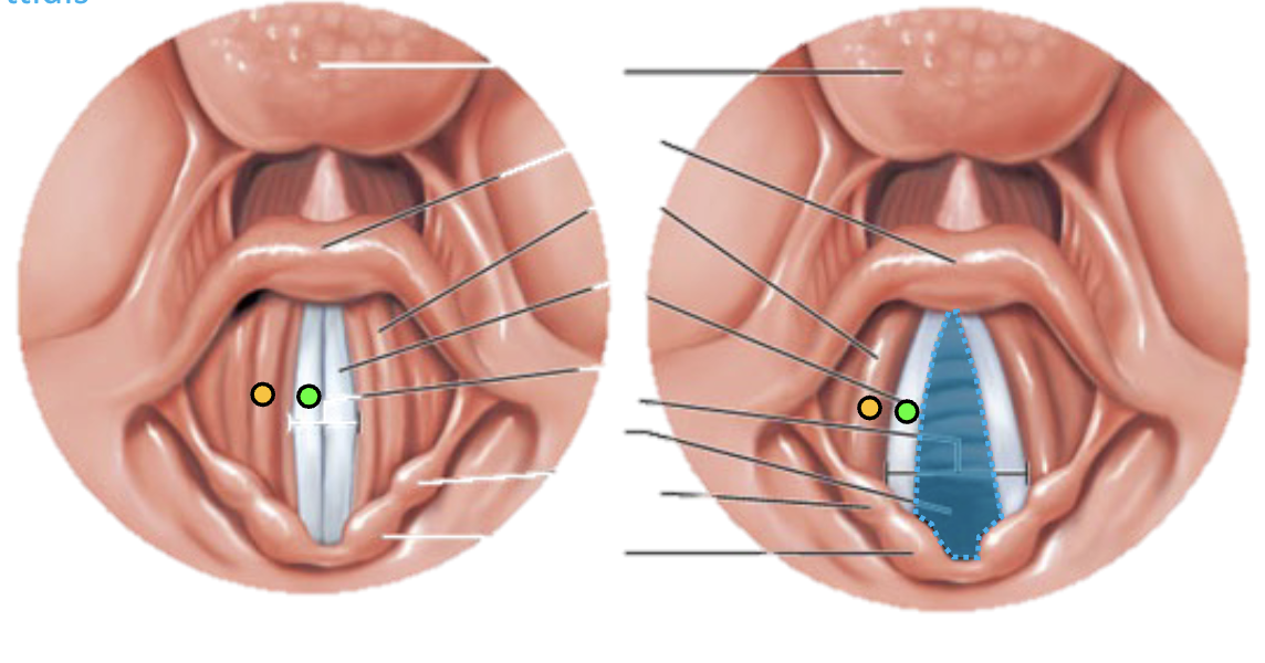 <p>Rema Glottides</p>