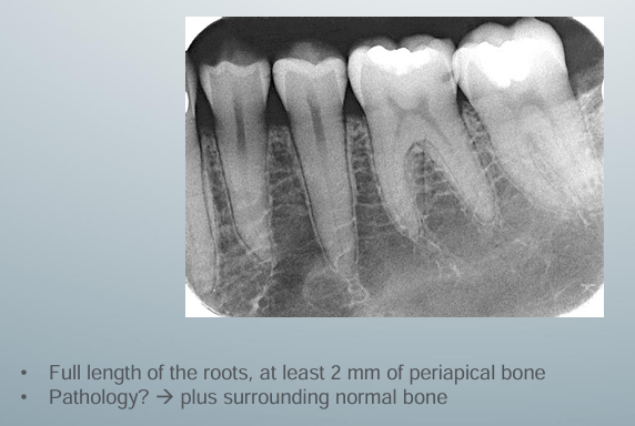 <p>-ensure nothing is distorted</p>
