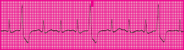 <p>Which rhythm is this?</p>