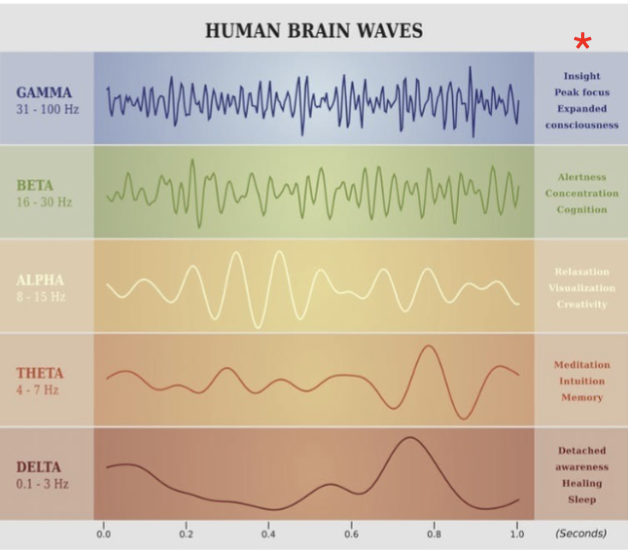 <p>Electroencephalogram (EEG)</p>