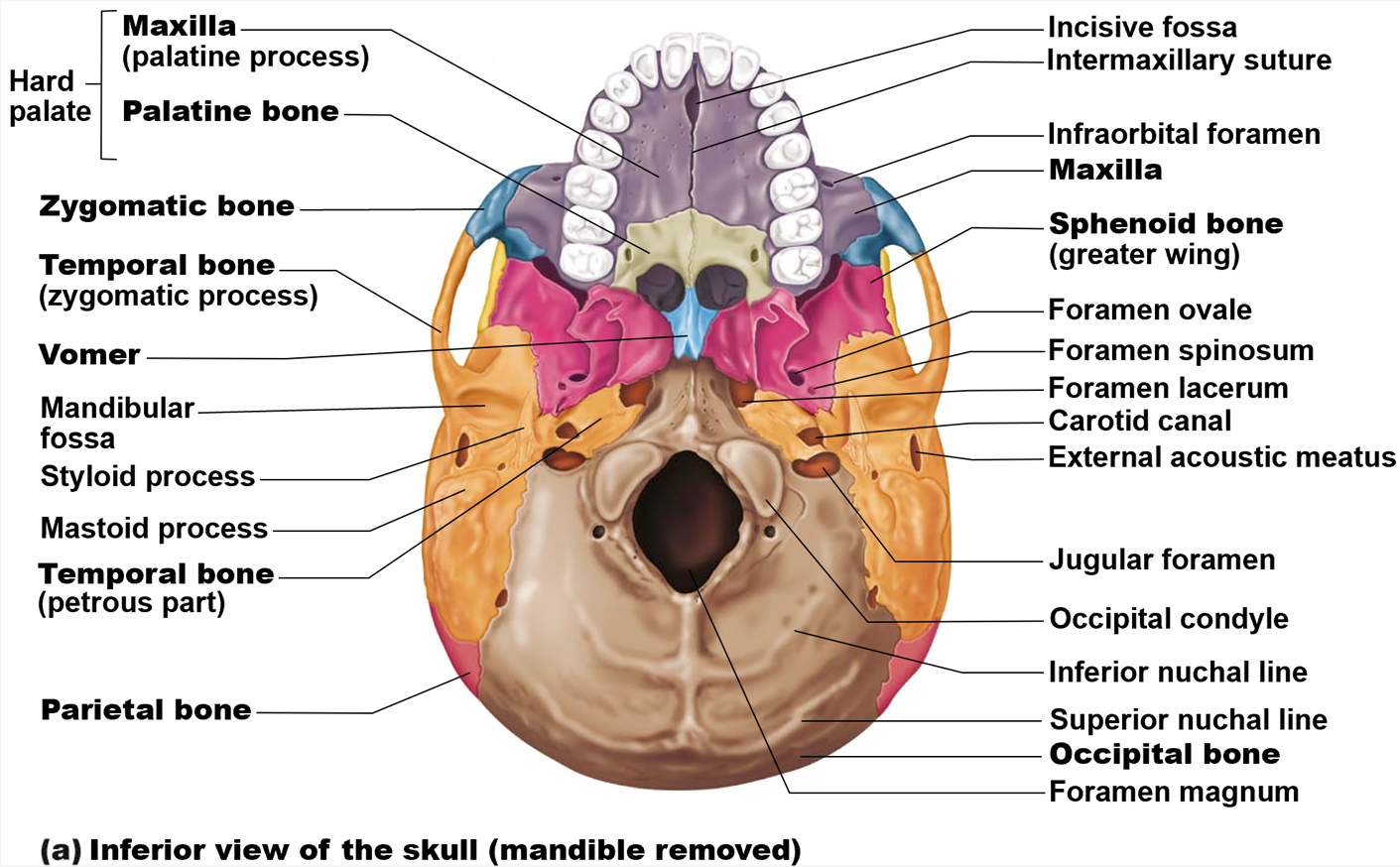 <p><strong>Maxilla (palatine process), Palatine bone, Zygomatic bone, Temporal bone (zygomatic process), Vomer, </strong>Mandibular fossa, Styloid process, Mastoid process, <strong>Temporal bone, Parietal bone, </strong>Incisive fossa, Intermaxillary suture, Infraorbital foramen, <strong>Sphenoid bone</strong> (greater wing), Foramen ovale, Foramen spinosum, Foramen lacerum, Carotid canal, External acoustic meatus, Jugular foramen, Occipital condyle, Inferior nuchal line, Superior nuchal line, <strong>Occipital bone, </strong>Foramen magnum</p>