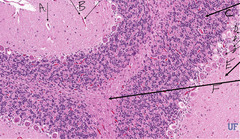 <p>What cells are indicated by the arrows 'D' in this slide of cerebellum and medulla?</p>