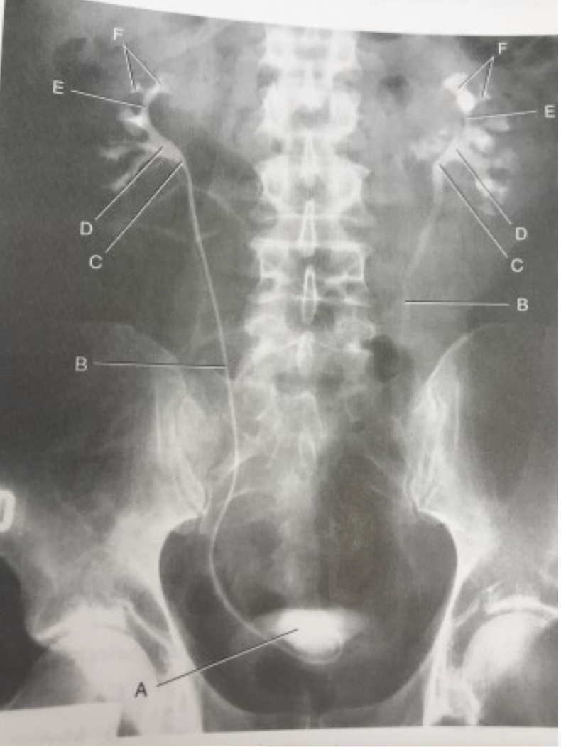 <p>label this image</p>