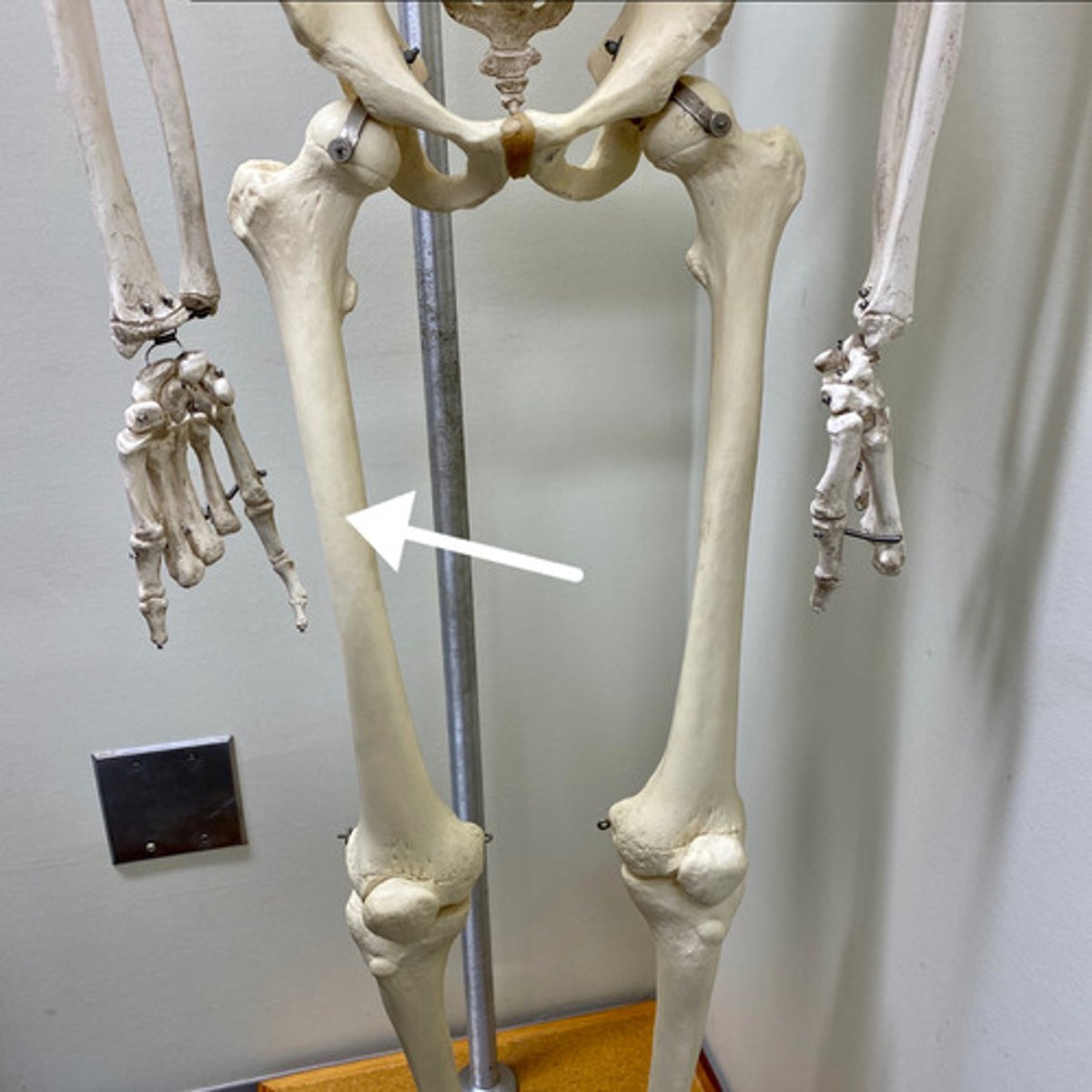 <p>What is this bone?</p>