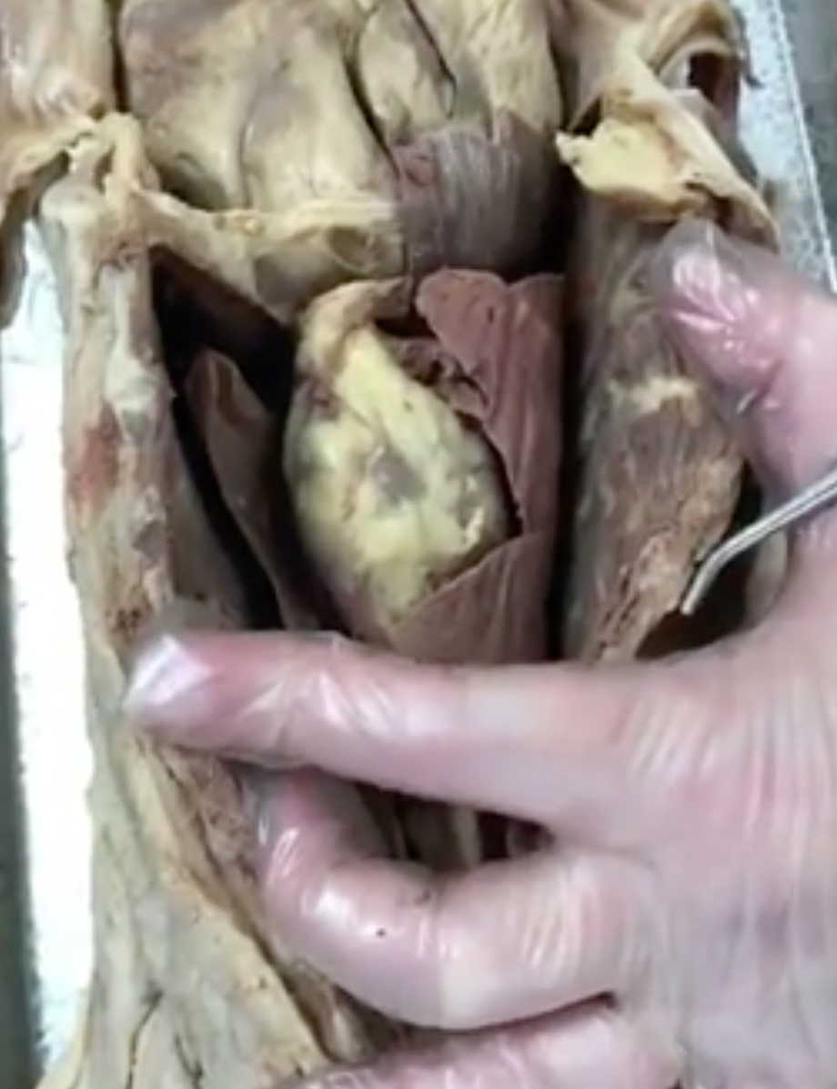 <p>what structure is she separating with her fingers</p>