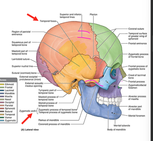 <ul><li><p>includes lateral aspects of <strong>frontal, parietal, zygomatic, sphenoid bones & temporal bones</strong></p></li><li><p><strong>temporal fossa</strong></p><ul><li><p>bounded sup. & post. by<strong> sup & inf temporal lines</strong></p></li><li><p>bounded ant. by frontal & zygomatic bones</p></li><li><p>bounded inf. by zygomatic arch</p></li></ul></li><li><p><strong>zygomatic arch</strong></p><ul><li><p>anterolateral projection of temporal bone & lateral aspect of zygomatic</p></li></ul></li></ul><p></p>