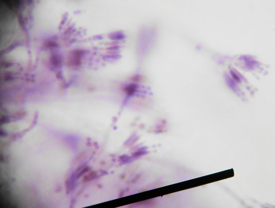 <p>What disease do Penicillium cause?</p>