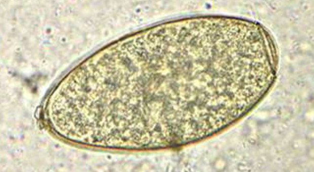 <p>Name of two organisms (cannot distinguish eggs); hint = very large egg (~140 um)</p>