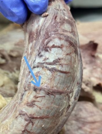 <p>deep dorsal vein</p>