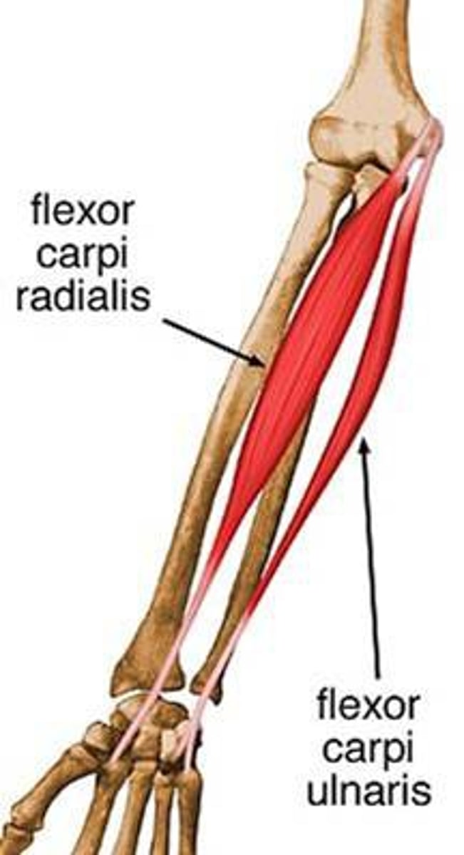 <p>common flexor tendon</p>