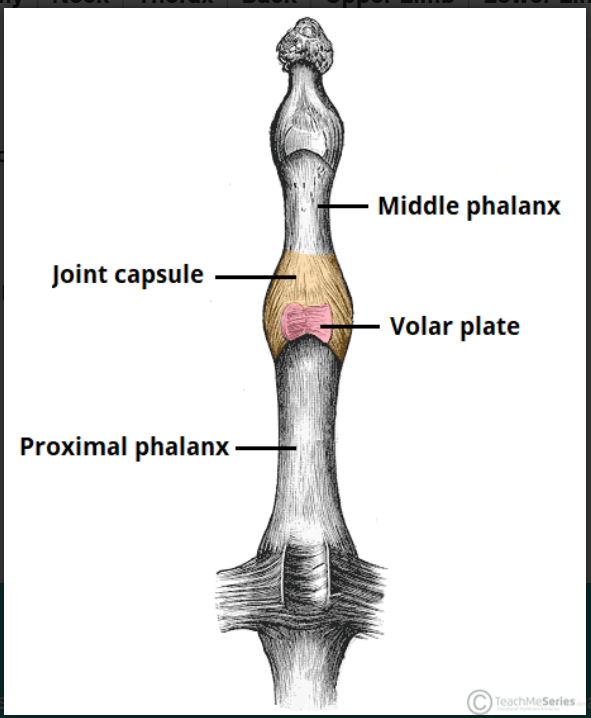 <p>Palmar ligaments/volar plates. (same thing)</p>