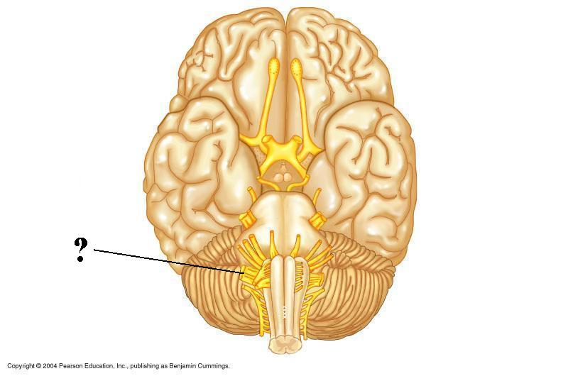 <p>Identify the indicated cranial nerve</p>