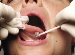 <p>(Microscopic Diagnosis)</p><p>A _______ can be used to obtain information from oral mucosal epithelium. During this test, a circular brush is used to obtain cells from the full thickness of the epithelium. The results aid in determining if a surgical biopsy is needed to establish a definitive diagnosis</p>