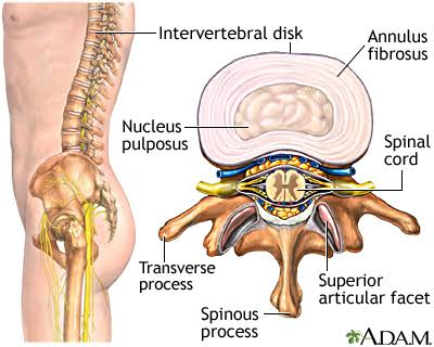 <p>Fibrocartilage cushion between vertebrae.</p>