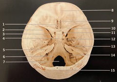 <p>What structure is #11? (Fig. 3.6 Cranium, Posterosuperior View)</p>