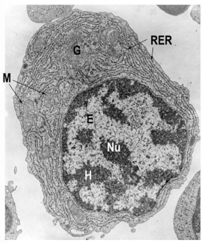 <p>Wat zijn de donkere gebieden in de elektronenmicroscopische afbeelding van de celkern?</p>