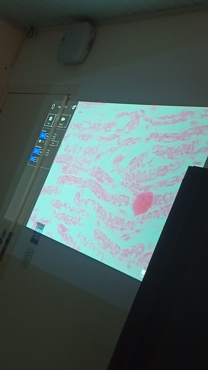 term image
