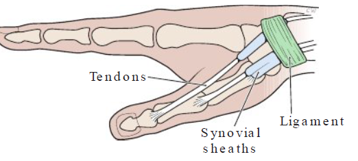 <p><strong>Definition</strong></p><ul><li><p>Inflammation of tendons (side of wrist & base of thumb) </p></li></ul><p></p><p><strong>Causes</strong></p><ul><li><p>Hand twisting, forceful gripping, bending hand back or to side</p></li></ul><p></p><p><strong>Symptoms</strong></p><ul><li><p>Pain on side of wrist, base of thumb, cracking noise</p></li></ul><p></p>