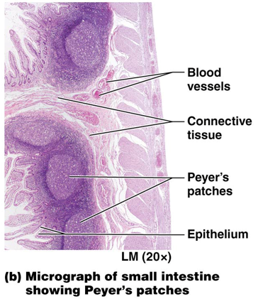 <p>defend against any bacteria that have escaped from the large intestine </p>