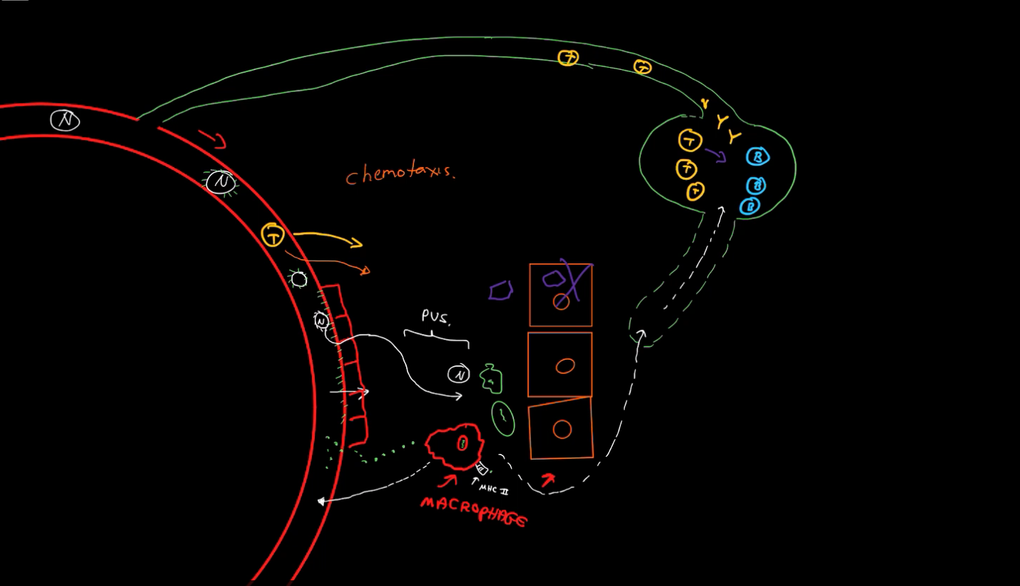<ol><li><p>Macrophage phagocytes a harmful pathogen.</p></li><li><p>The Macrophage releases cytokines, a chemical messenger.</p></li></ol><ul><li><p>Endothelial cells express “sticky” proteins</p></li><li><p>Neutrophils also express “sticky proteins</p></li></ul><ol start="3"><li><p>When neutrophils get close to these endothelial cells, they stick together, guiding neutrophils to the infection.</p></li><li><p>Neutrophils enter via diapedesis, they consume the bacteria, and die.</p></li><li><p>Macrophages present the pathogen on MHC 2.</p></li><li><p>Macrophages travel down the lymphatic vessel, into a lymph node, and activate B-Cells and T-Cells</p></li><li><p>The B-Cells, T-Cells, and their associated antibodies travel into the blood and towards the site of infection via chemotaxis.</p></li></ol><p></p>
