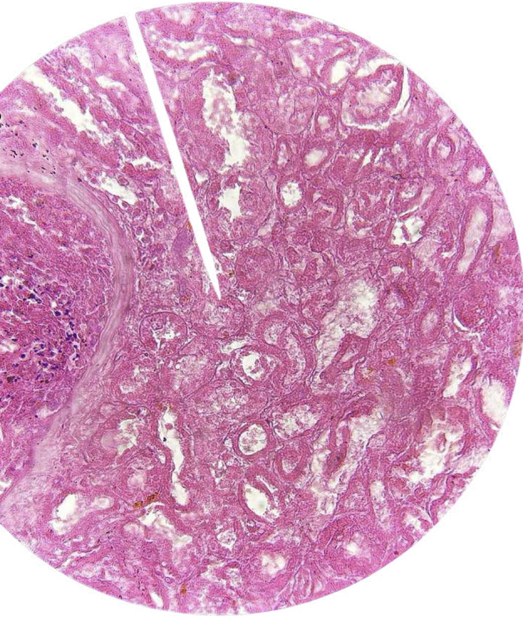 <p>diagnose, type of cell injury, reversible/irreversible</p>
