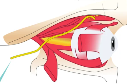 <p><span>The fourth cranial nerve. Motor nerves that innervate the superior oblique muscles of the eyes. Responsible for downward vertical and inward rotation of the eye. This nerve is checked by asking a patient to follow an object with their eyes.</span></p>