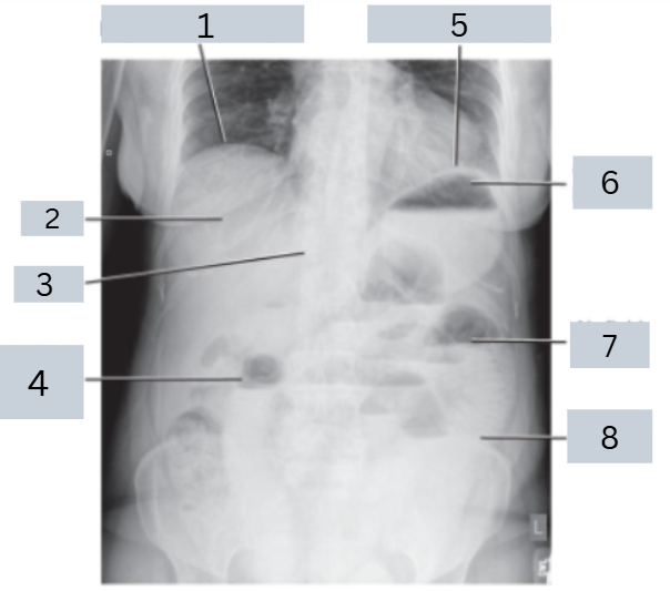 <p>label radiograph</p>