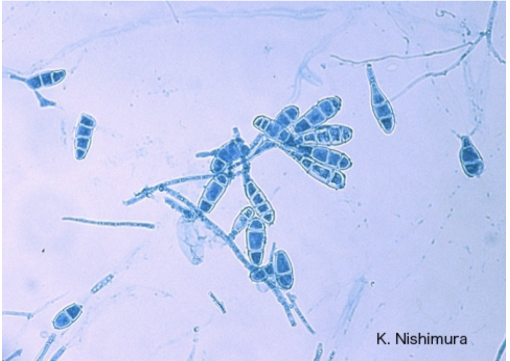 <p>-Skin and nail infections</p><p>-Colony is yellow, olive-gray, or khaki</p><p>-Reverse of colony is orange-brown</p><p>-Smooth club shaped macroconidia with rounded ends, often found in clusters of 2-6 cells</p><p>-No microconidia</p>