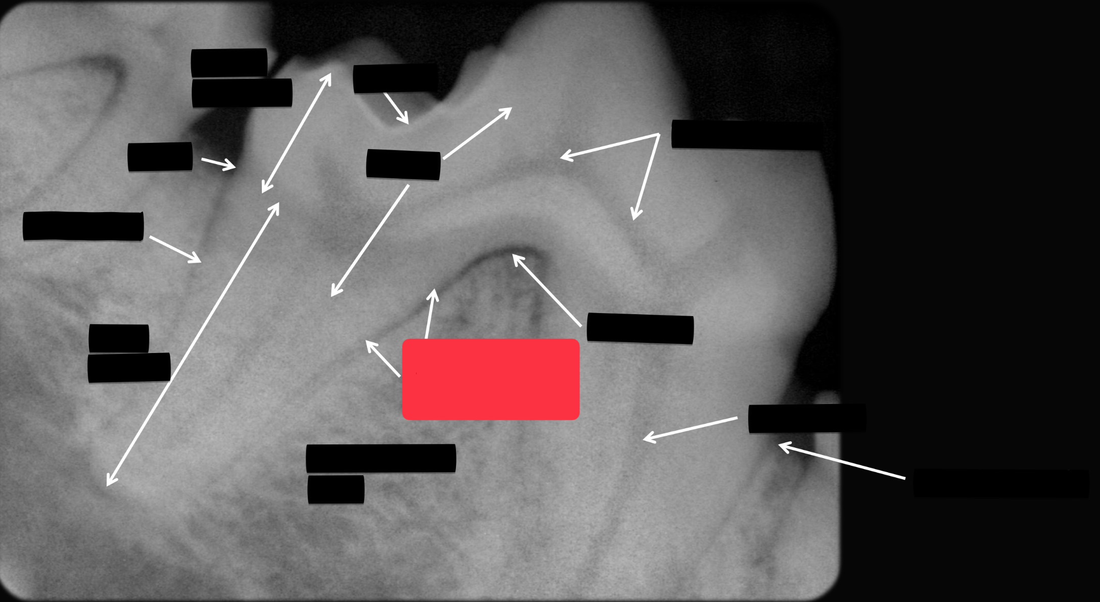 <p>Label this part of the tooth.</p>