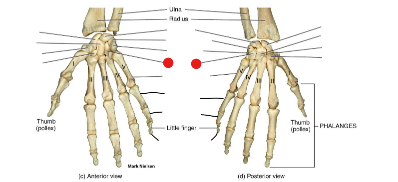 <p>Identify the structure pinned</p>
