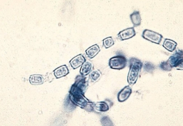 <p>Train track arthroconidia</p>