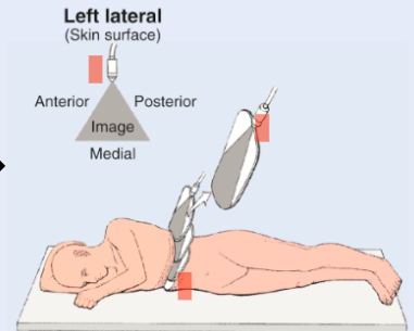 <p>Patient lays on right side</p><p>Enables scanning of left lateral surface</p>