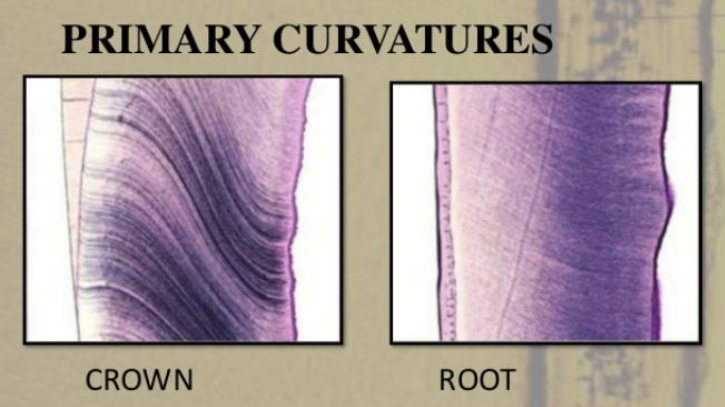 <p>Look primary curvatures of dentinal tubules </p>