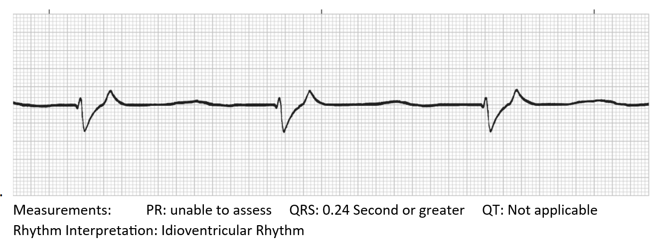 <p>Idioventricular Rhythm</p>