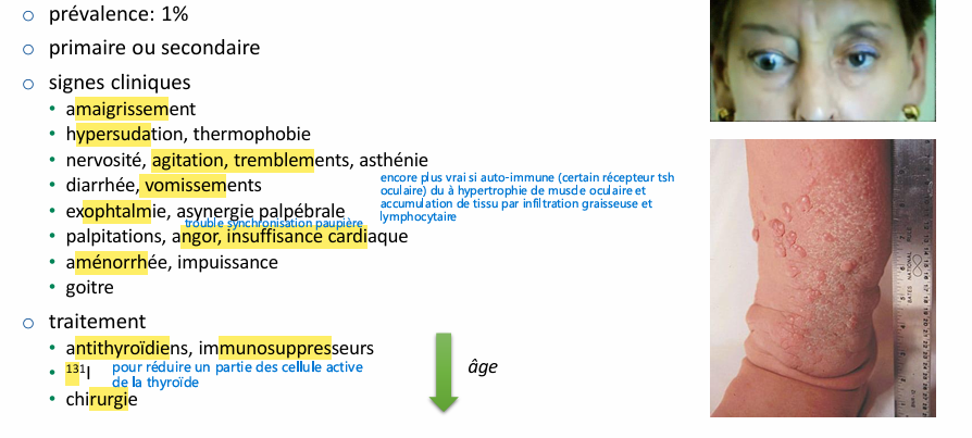 <p>troubles oculaires mets bcp de temps à cse corriger </p>