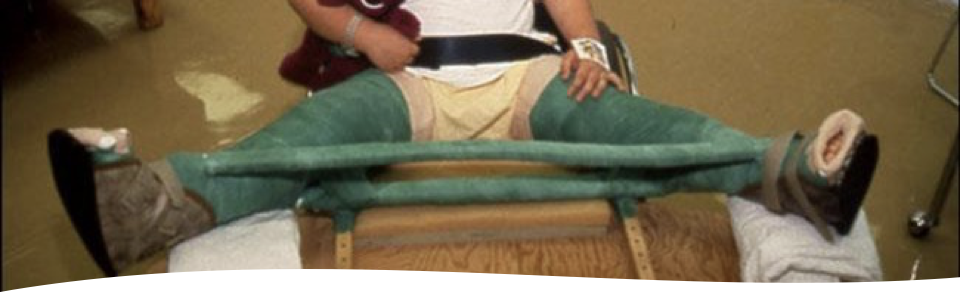 <p>it’s the same but legg-calve perthes is non-weight bearing </p>