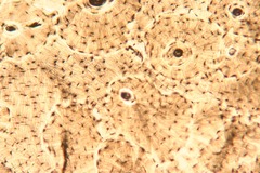 <p>Connective tissue. Scattered cells. Cells are in the black spots</p>
