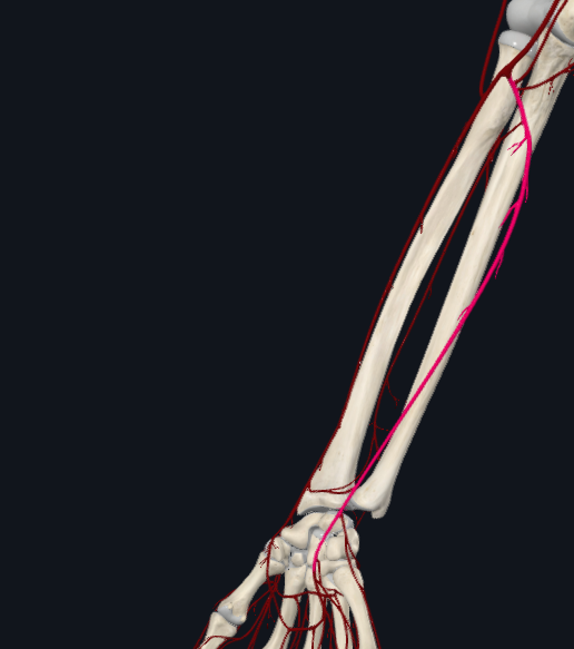 term image