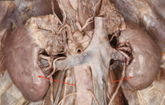 <p>name this structure</p>