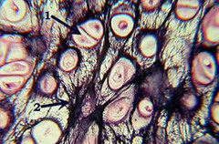 <p>Cartilage: elastic</p>