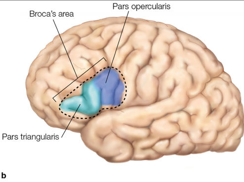 <p>Broca’s Aphasia: <strong>Nonfluent/Expressive Language Impairment</strong></p>