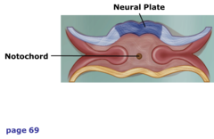 <p>stiffening rod in the back just deep to the spinal cord</p>