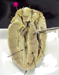 <p>Chamber</p>