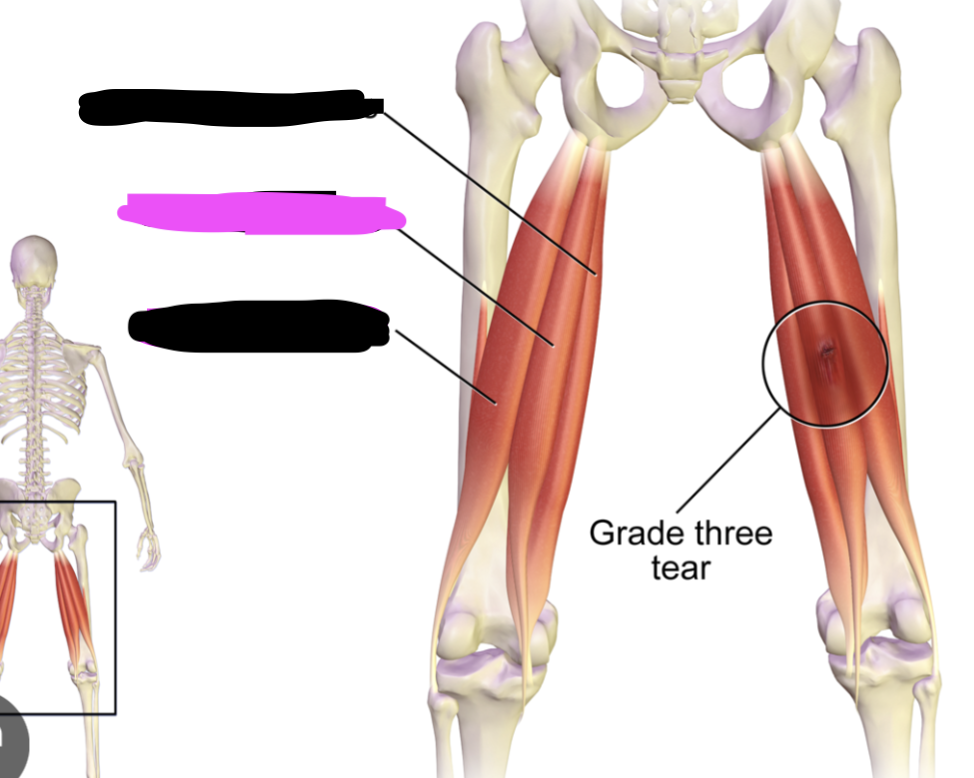 <p>Flex knee - extends hip, flexes knee</p>
