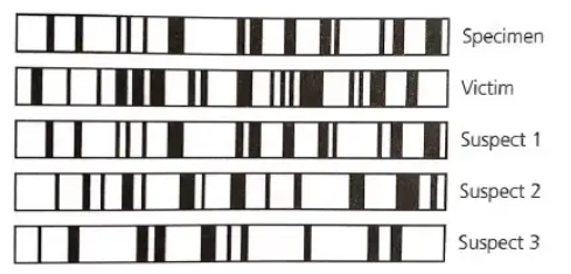 <p>-suspect 1 is guilty</p><p>-suspect 1’s profile matches the the profile of specimen</p><p>-DNA from suspect 1 is identical to the specimen</p><p></p><p>might not be guilty</p><p>→hair may be planted</p><p>→more evidence is needed e.g. alibis and witnesses should be considered</p>