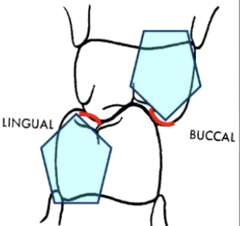 <p>- inner inclined planes of non-supporting cusps are also functional inclined planes</p><p>- non-supporting cusp normally has 2 functional inclined planes</p>
