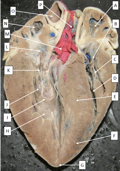 <p>Label A</p>