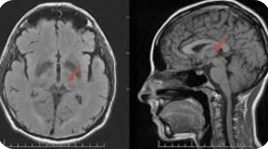 <p>Name the part of the brain, modality, and planes</p>